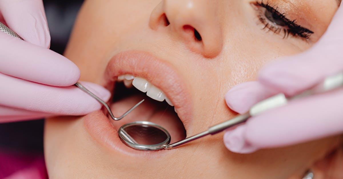 découvrez tout ce qu'il faut savoir sur le remboursement dentaire : comment fonctionnent les assurances, les étapes à suivre pour obtenir un remboursement et les conseils pour optimiser vos dépenses de santé bucco-dentaire.